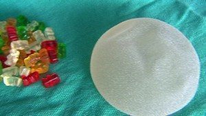 Gummy Bear Breast Implant