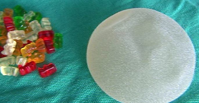 What are gummy bear breast implants?