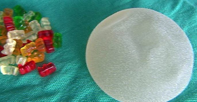 What Do You Need to Know About Gummy Bear Breast Implants